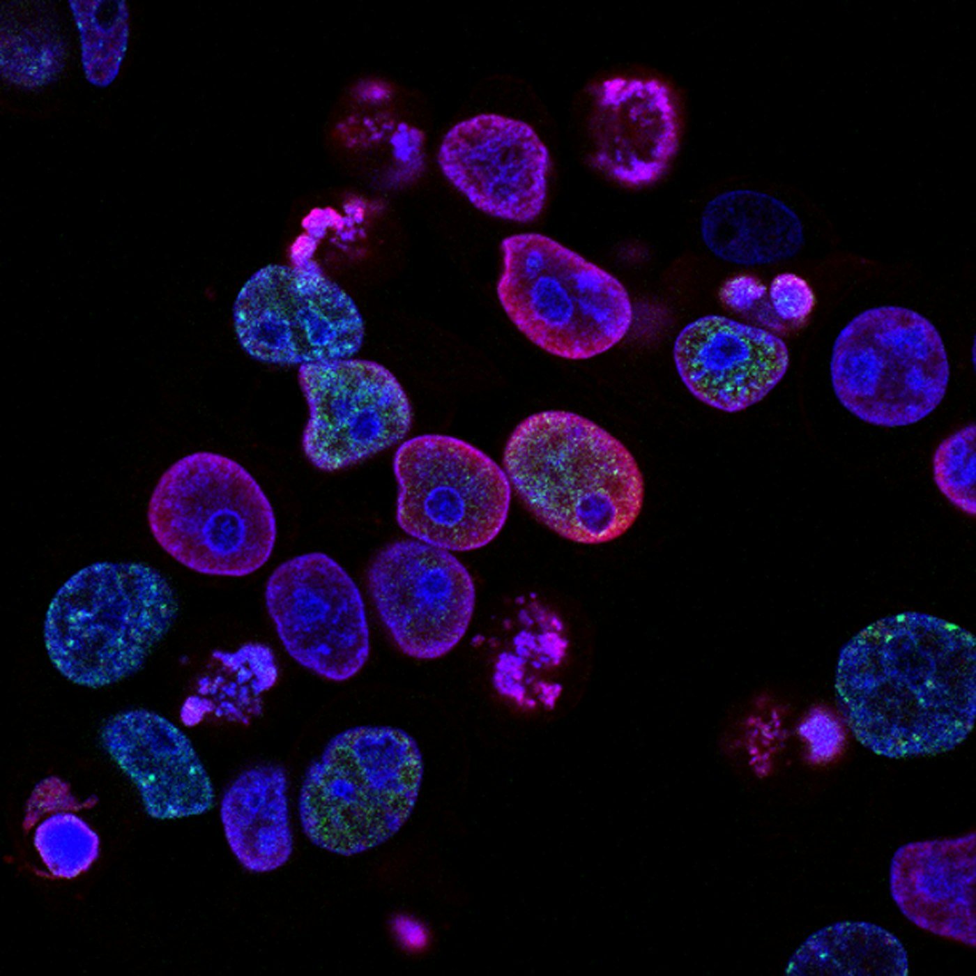 Cells under a microscope